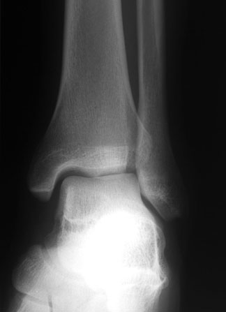 click to go to pathologies