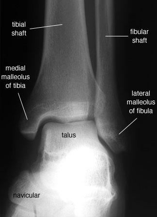 labelled anatomy of ankle