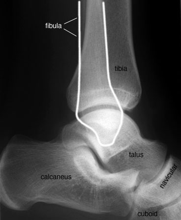labelled anatomy of lateral ankle
