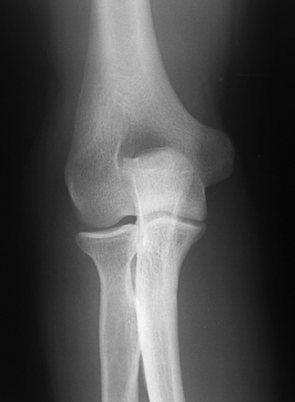 click to go to pathologies