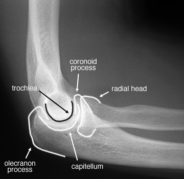 labelled anatomy of lateral elbow