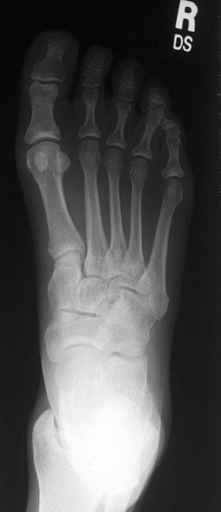 click to go to pathologies