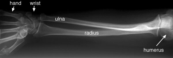 labelled anatomy of forearm