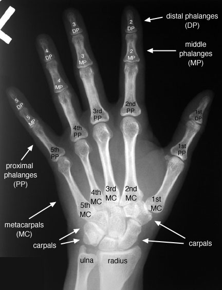 labelled anatomy of hand