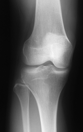 click to go to pathologies