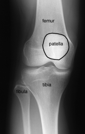 labelled anatomy of knee