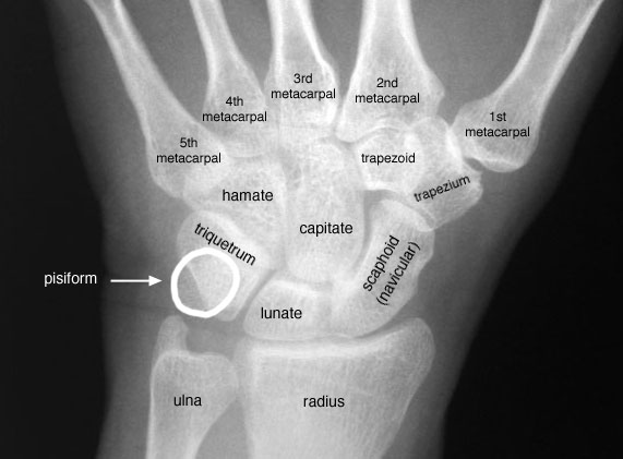 anatomy of wrist