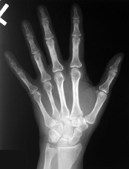 Click to go to pathologies