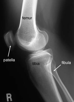 labelled anatomy of lateral knee
